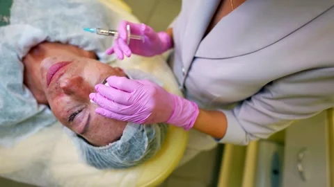 Close-up of a woman's face during a cosmetic procedure, a syringe with a needle  Stock Footage 288609986