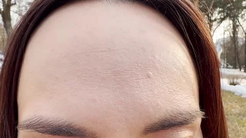 Close-up of a woman's forehead skin texture, natural beauty at its finest Stock-Footage 330944344