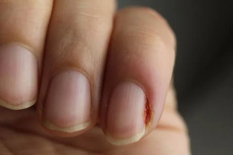 Close-up of a woman's hand nails without manicure. Clean hands Stock Photos