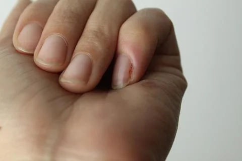 A close-up of a woman's left hand. Hand care. Close-up Stock Photos