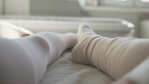 Close-up of the woman's leg in the cast of the longet when the Achilles tendon Stock Footage 150734093