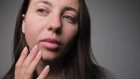 Close-up of a woman's lips with a visible cold sore touching her face, showing Video stock 304976401