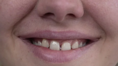 Close-up of a woman's smile. Stock Footage 274838726