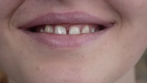 Close-up of a woman's smile. Stock Footage 275353209