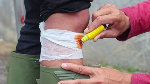 Close-up of worker applying antiseptic liquid to bandaged leg on construction Vidéo 336728910