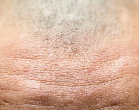 Close-up on wrinkled forehead Stock Photos