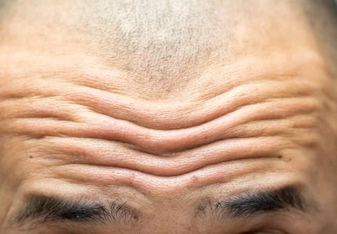 Close-up on wrinkled forehead Stock Photos