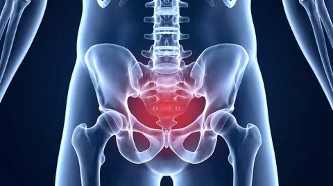 Close up X ray of human sacrum and hip structure with intense inflammation .. Stock Illustration