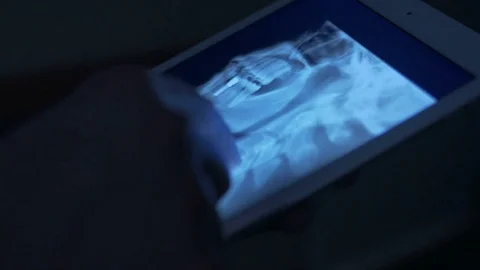 Close-up of an x-ray image on a tablet Stock Footage 75133921