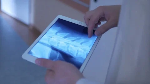 Close-up of x-ray on the tablet Stock Footage 75131606