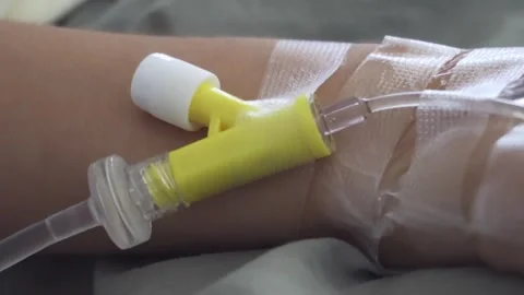 Close-up of Yellow IV Catheter Secured to Patient Arm with Transparent Tape Видео 339073056