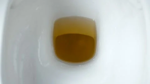 Close-up of yellow pee flushing down the toilet Vídeo Stock 86879098
