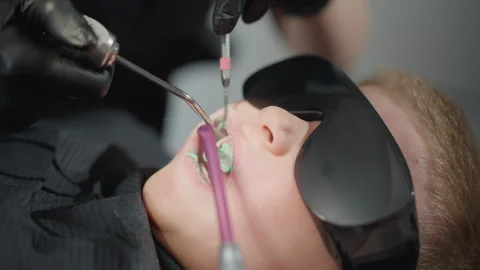 Close up young boy receiving orthodontic oral healthcare with instruments and Stock Footage 345092472