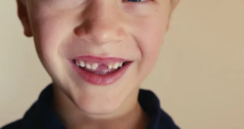 Close-up of a young boy smiling showing his missing tooth Vidéo 346983061
