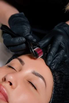 Close Up Young Cosmetologist Using Mesoroller. Young Beautician Using a Derma Stock Photos