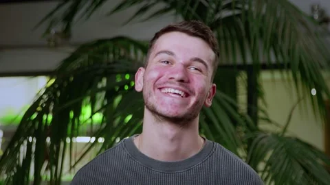 Close-up of a young man with pimples on his face. The guy laughs. Problematic Stock Footage 205300521