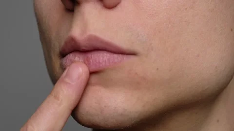 Close-up of a young man pointing to dry lips with his finger, emphasizing the ne Stock Footage 296421179