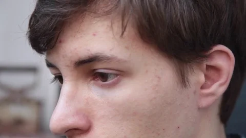 Close-up of young man’s face outside Stock Footage 80384016