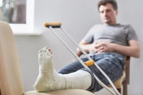 Close up of a young man's Plaster leg cast and after a running injury or fall Stock Photos