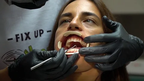 Close-up of young woman with expander in mouth during inspection of oral cavity Stock Footage