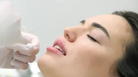 Close-up of a young woman's face undergoing lip augmentation procedure 動画素材 267751234
