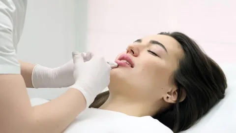 Close-up of a young woman's face undergoing lip augmentation procedure 動画素材 267752007