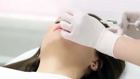 Close-up of a young woman's face undergoing lip augmentation procedure 動画素材 267752333