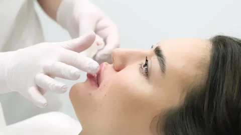 Close-up of a young woman's face undergoing lip augmentation procedure Stock Footage 267754749