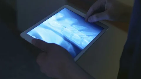 Close-up of zooming an x-ray image Stock Footage 75131994