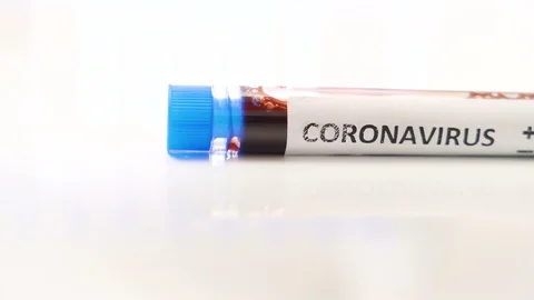 Closer look of the small sampling tube for coronavirus Stock Footage 128008052