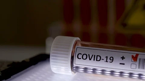 A closer look of the test kit with Covid-19 positive mark for coronavirus Stock Footage 127768101