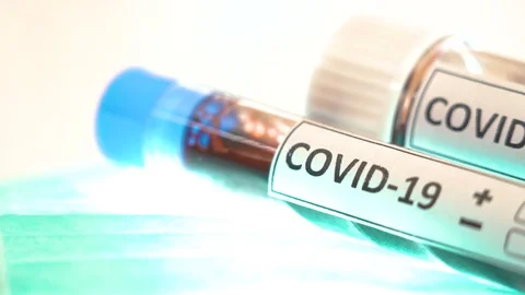 Closer look of the two positive kits for coronavirus Stock Footage 127772522