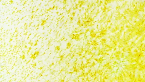 Closeup of with Bacteria, Part of Microbiome and Causative Agents of Different Stock Footage 276994025