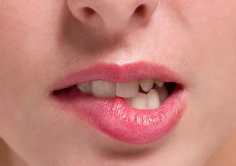 Closeup bites on lips Foto stock