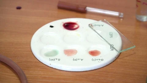 Closeup of blood samples on the table in the lab Stock Footage 76902585