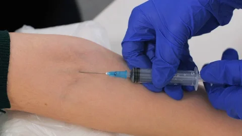 Closeup of blood sampling from vein. Stock Footage 128373579