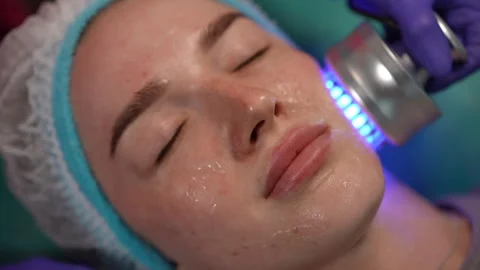 Closeup of blue LED light therapy on young woman face during skincare treatment Stock Footage 311367099