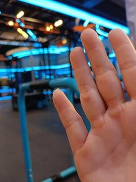 Closeup of calloused left palm Stock Photos