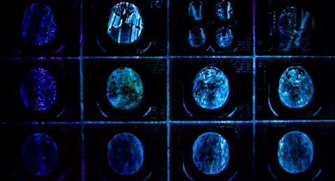 Closeup of a CT scan with brain and skul... | Stock Video | Pond5