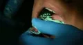 A closeup of a dental imprint HD Footage