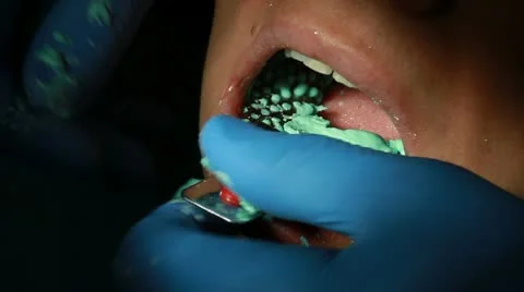 A closeup of a dental imprint Stock Footage 10718393