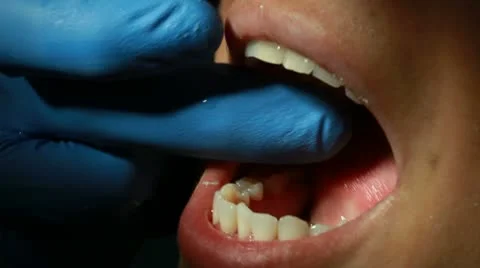 A closeup of a dental imprint Stock Footage 10718450