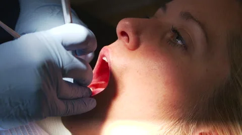 Closeup Dentist Cleaning Woman's Teeth Video stock 43309045