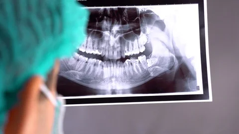 Closeup of dentist looking at dental x-ray plate. At a reception the dentist Stock-Footage 101790803