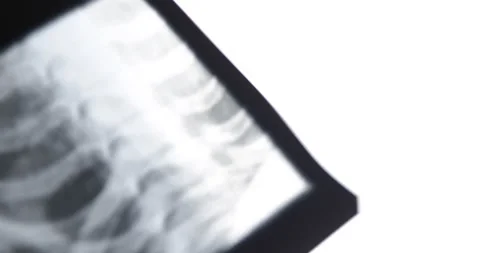 Closeup of different x-ray images on the table Stock-Footage 233330675