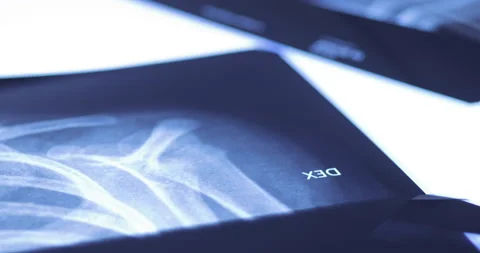 Closeup of different x-ray images on the table Stock-Footage 233334790