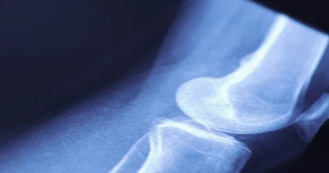 Closeup of different x-ray images on the table Stock-Footage 233339847