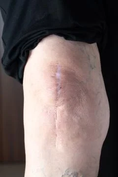 Closeup of elderly person's knee or elbow 스톡 사진