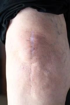 Closeup of elderly person's knee or elbow Fotos de archivo