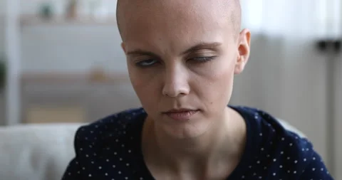 Closeup face gloomy bald woman sit indoo... | Stock Video | Pond5